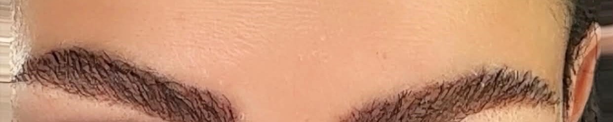 Après greffe de sourcils : arcade dense et naturelle